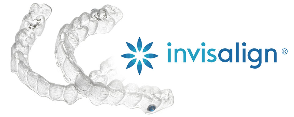 Rights Reserved Invisalign Teen The 58
