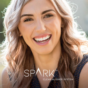 spark clear aligners for adults