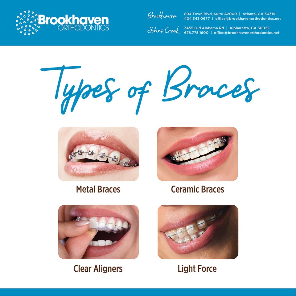 types of braces orthodontic treatment in atlanta georgia